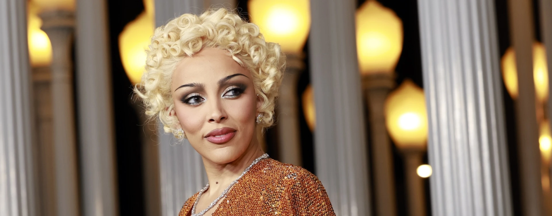 Doja Cat May Have Lipedema: Diagnosis and Symptoms Explained Doja Cat May Have Lipedema: Diagnosis and Symptoms Explained